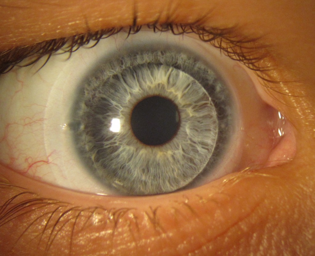 HK The Scleral Lens Center The Scleral Lens Center